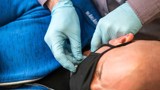 Dry Needling.